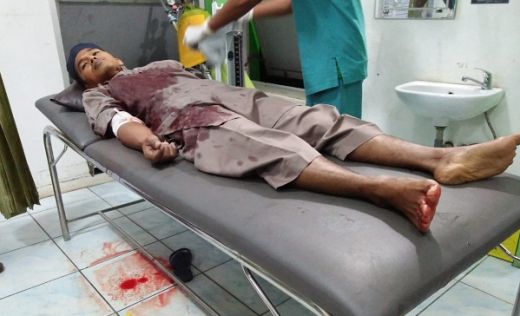 Gagalkan Pencurian Motor di Halaman Masjid, Anggota TNI Terluka di Sijunjung