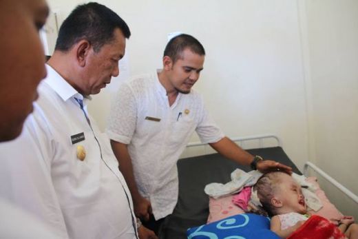 Menderita Kepala Membesar, Bocah Asela di Silaut Pesisir Selatan Butuh Bantuan Donatur