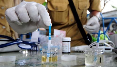 Ondeh Mandeh... Tes Urine di Sekolah, 19 Siswa di Padang Positif Narkoba