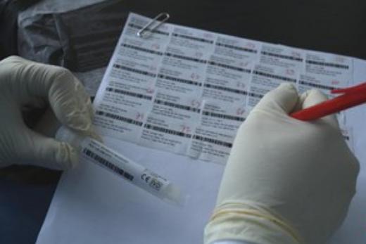 DPR Dorong Investigasi Dugaan Kerugian Negara dalam Pengadaan Alat Antigen